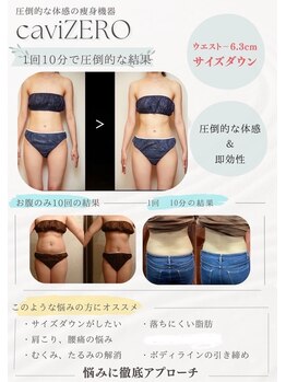 リオラ ビューティー(Liora beauty)/キャビゼロ導入!