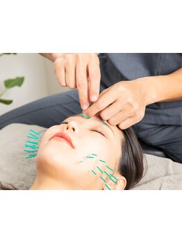 小顔になりたい