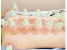 ティグリス(TIGRIS)/カッピング