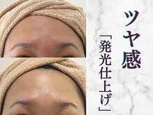 リボーン 柏(REBORN)/美白フォトで“透明ツヤ肌”印象