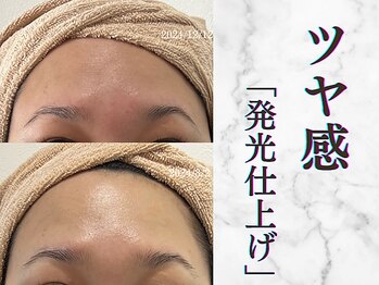 リボーン 柏(REBORN)/美白フォトで“透明ツヤ肌”印象