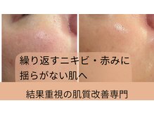 アリィ(Alii hisaya)