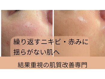 アリィ(Alii hisaya)