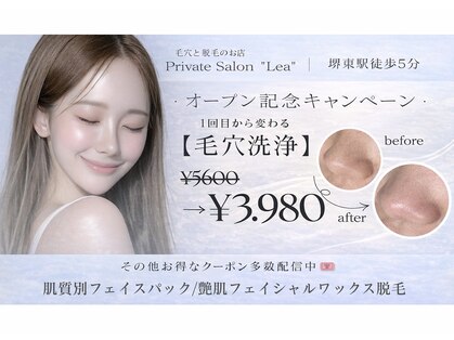 レア(Lea)の写真