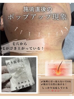 ヴァリエ(Varier)/ポップアップ現象