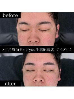 ユー 千葉駅前店(you)/ビフォ－アフター写真