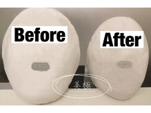 美極 トータルビューティー(美極 TOTAL BEAUTY)/恵比寿/小顔コルギ/エステ/