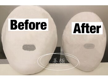 美極 トータルビューティー(美極 TOTAL BEAUTY)/恵比寿/小顔コルギ/エステ/