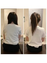 ハルノハナ鍼灸治療院/改善例♪