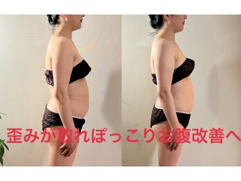 サントーシャ(Santosha)/歪みが取れぽっこりお腹改善!