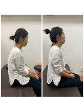 福岡西新整骨院/ビフォーアフター
