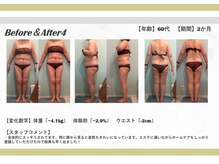 エミット(emit.)/ダイエットコース