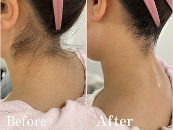 クイーン 渋谷店(QUEEN)/成人式前撮り前に！