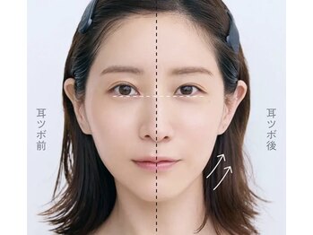 マイロ 原宿(Myro)/耳ツボジュエリー