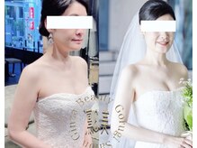 凛&美 銀座の雰囲気（Instagramで動画♪挙式前日透明艶肌小顔最終仕上げ～本気改善）