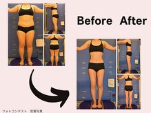 ミネルバエンダモロジー/エンダモロジー/痩身/ウェルネス