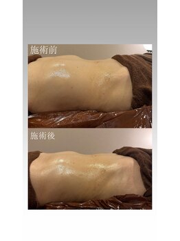 エスエー(SA)/腸もみ初体験の40代のお客様