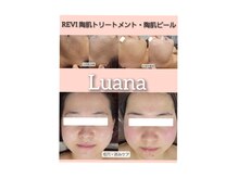 ルアナ(Luana)