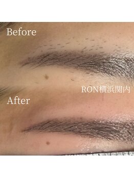 サロンロン 横浜関内(SALON RON)/眉毛のムダ毛/美容電気脱毛
