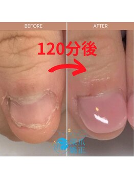 ブルームブルーム(BLOOMブルーム)/ちゅるんと仕上げ