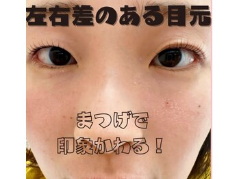 ピグレ(Pigrer)/左右差のあるお目元もお任せ♪