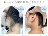 【人気パーツ】ブラジリアンワックス【うなじ】単品4000円