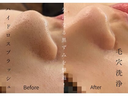 リアン(Lien)の写真