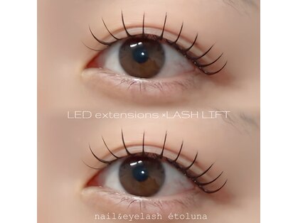 エトルナ(etoluna)の写真