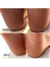 シャルム ド ケー(charme de k)/極上足裏角質ケア