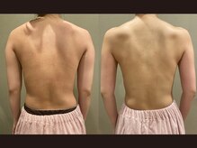 エス シークレット 金町店(S secret)/リバウンド常連歓迎/ブライダル