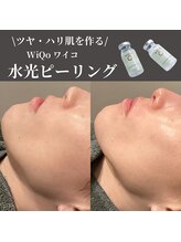 ノーブルノアール(Noble noir)/毛穴つるん水光ケア★☆