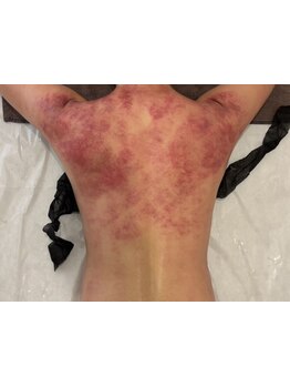 くびれを手に入れたい