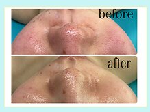 エクラニーク(Eclanique)