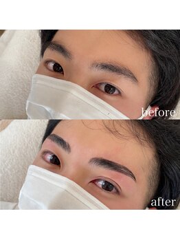 ダリ(Dali)/メンズハリウッドブロウリフト