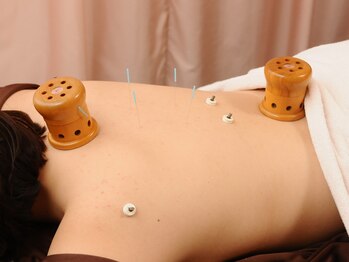 ふわりはり灸整体院/おうちでできる温灸器も販売中♪