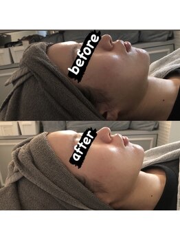 ディライト 名古屋駅店(Delight)/二重顎ケアに