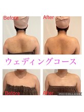 ミエル(Miel)/Before After