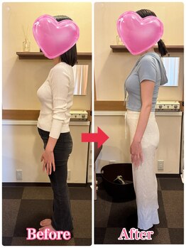 はやしだ鍼灸整骨院/姿勢改善ダイエット,骨盤矯正