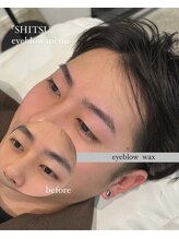 シツ(SHITSU)/症例【before・after】眉毛Wax