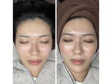 白雲木/透明感アップ♪透き通る肌へ