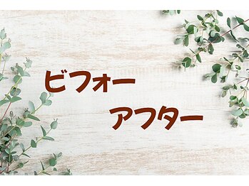 アイビー(Aibey)/