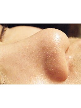 毛穴ケアをしたい