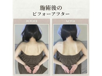 恵比寿にしむら整体院の写真/【恵比寿駅徒歩2分】挙式直前も◎美姿勢・デコルテ・肩甲骨ラインブライダル整体90分