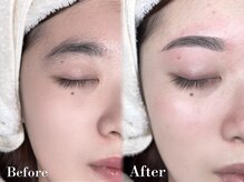ベルダ(BELDAD)/お顔に合わせた眉毛デザイン