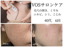 エルール トータルビューティ(Aileure total beauty)