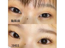 フリルアイビューティー フィガロ 北生駒店(Frill eye Beauty Figaro)の雰囲気（目の疲れが取れるアイストレッチも人気☆【北生駒店】）