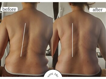 ブルー ジェイド(BLUE JADE)/筋膜リリースbefore　after