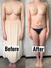 ノート(Naught)/大好評☆育乳バストケアメニュー