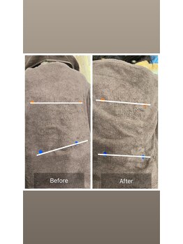 プリューム(PLUME)/骨盤矯正でボディラインも◎