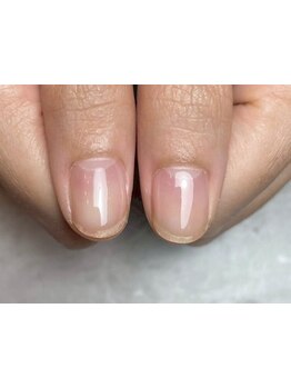 爪の悩みを解消できる（ケア含む）